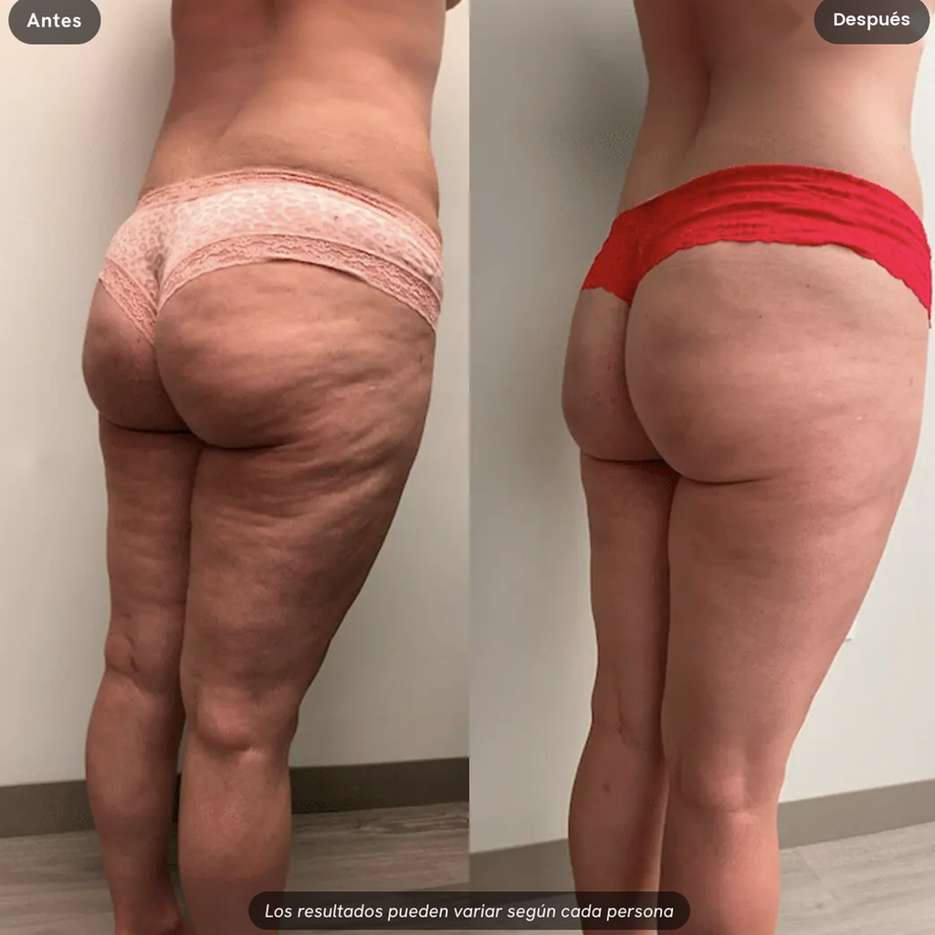 Sculpiflex — Kit completo
